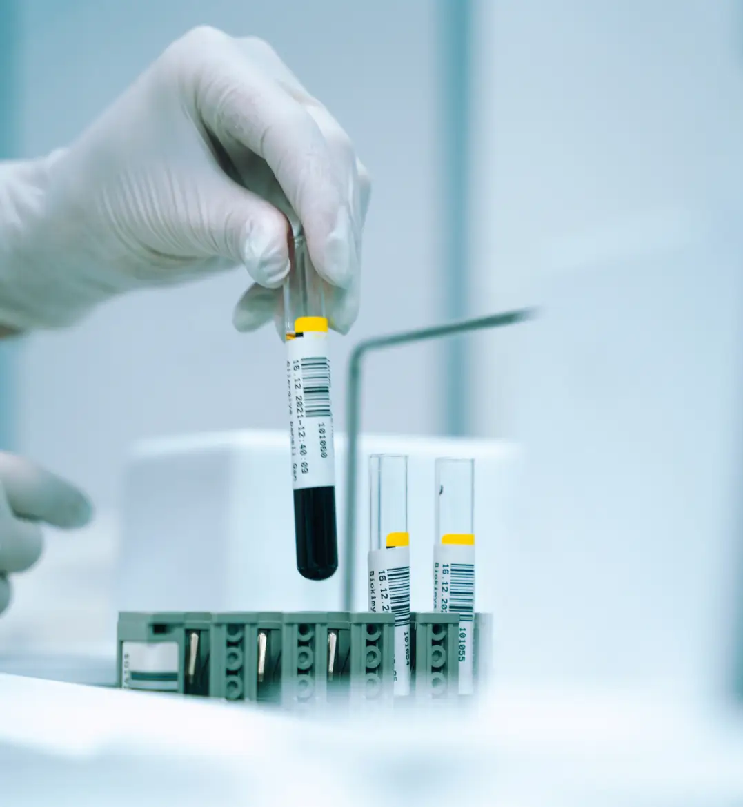 Laboratory technician in gloves handling a blood sample in a test tube, with additional test tubes in a rack, highlighting clinical testing and analysis procedures.