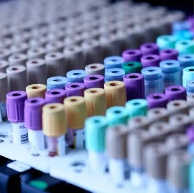 Close-up view of a collection of colorful laboratory test tubes arranged in a rack, showcasing various cap colors used for different blood sample types in medical testing.